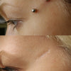 Close-up of a woman's face showing surgical steel dermal anchor body jewelry placed on the upper cheekbone area.